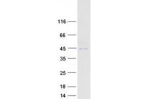 Validation with Western Blot