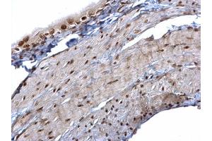 Immunohistochemistry (IHC) image for anti-Heterogeneous Nuclear Ribonucleoprotein K (HNRNPK) antibody (ABIN2855169)