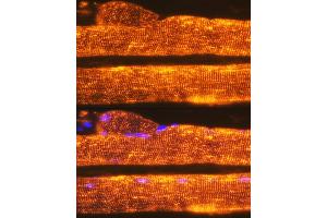 Immunofluorescence analysis of Rat skeletal muscle using Calsequestrin 1 antibody (ABIN7266045) at dilution of 1:100. (Calsequestrin antibody)