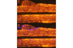 Immunofluorescence analysis of Rat skeletal muscle using Calsequestrin 1 antibody (ABIN7266045) at dilution of 1:100.