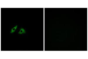Immunofluorescence analysis of HeLa cells, using GPR152 antibody. (GPR152 antibody  (Internal Region))
