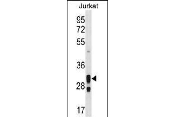 ACER1 antibody  (C-Term)