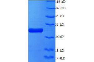 SDS-PAGE (SDS) image for X-Ray Repair Complementing Defective Repair in Chinese Hamster Cells 6 (XRCC6) (AA 6-222), (partial) protein (His tag) (ABIN5712169) (XRCC6 Protein (AA 6-222, partial) (His tag))