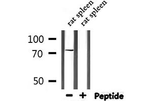 Western blot analysis of extracts from rat spleen, using GARS Antibody. (GARS antibody  (C-Term))
