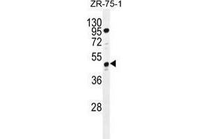 tcag7. (Tcag7.1071 (AA 417-438), (C-Term) antibody)