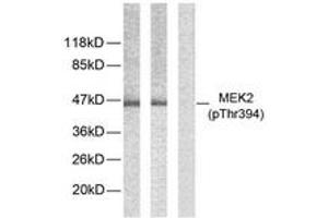 Western blot analysis of extracts from ovary cancer, using MEK2 (Phospho-Thr394) Antibody. (MEK2 antibody  (AA 261-310))