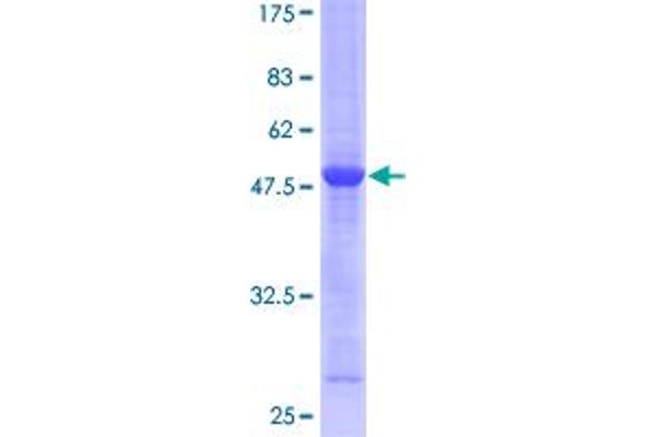 Rab5c Protein (AA 1-216) (GST tag)