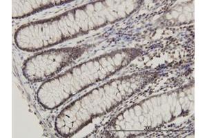Image no. 1 for anti-Ribosomal Protein L14 (RPL14) (AA 1-91) antibody (ABIN465975) (RPL14 antibody  (AA 1-91))