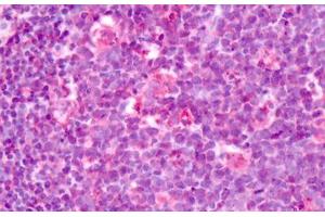 Anti-Latrophilin-3 / LPHN3 antibody IHC staining of human tonsil. (LPHN3 antibody  (C-Term))