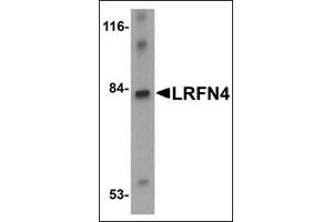 Western blot analysis of LRFN4 in rat brain lysate with this product at 1 μg/ml.