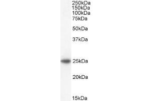 ABIN184699 staining (2µg/ml) of Human Adrenal Gland lysate (35µg protein in RIPA buffer). (BAK1 antibody  (N-Term))