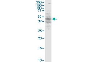 Western Blotting (WB) image for anti-B-Cell Linker (BLNK) (AA 301-400) antibody (ABIN526104)
