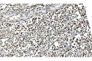 IHC analysis of Bim/BCL2L11 using anti-Bim/BCL2L11 antibody (ABIN7602855). (BIM antibody  (C-Term))