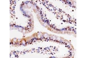 IHC testing of paraffin-embedded rat small intestine using Cdk4 antibody at 1:25. (CDK4 antibody  (AA 272-303))
