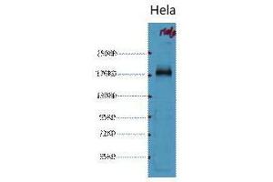 Western Blot (WB) analysis of HeLa, diluted at 1:1000. (EGFR antibody)