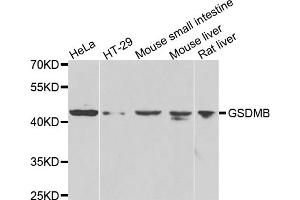 Western blot analysis of extracts of various cell lines, using GSDMB antibody (ABIN4903833) at 1:1000 dilution. (Gasdermin B antibody)