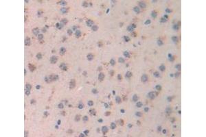 Figure. (LGALS7 antibody  (AA 2-136))
