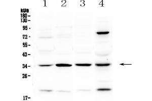 Western blot analysis of STUB1 using anti-STUB1 antibody . (STUB1 antibody  (AA 51-303))