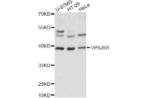 Western blot analysis of extracts of various cell lines, using VPS26A antibody (ABIN6292339) at 1:1000 dilution. (VPS26A antibody)