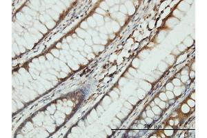 Immunoperoxidase of monoclonal antibody to SARS on formalin-fixed paraffin-embedded human colon tissue. (Seryl-tRNA Synthetase (SARS) (AA 1-514) antibody)