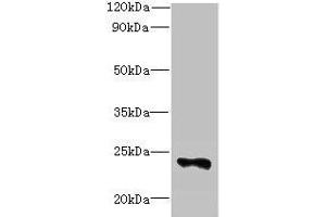 Western blot All lanes: FAM156A antibody at 5 μg/mL + Mouse heart tissue Secondary Goat polyclonal to rabbit IgG at 1/10000 dilution Predicted band size: 25 kDa Observed band size: 25 kDa (FAM156A antibody  (AA 1-153))