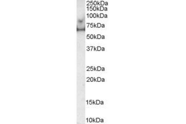 MARK4 antibody  (C-Term)