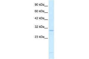 WB Suggested Anti-RALY Antibody Titration:  0. (Raly antibody  (N-Term))