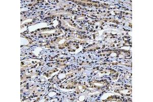 IHC analysis of CAD using anti-CAD antibody (ABIN7600044).