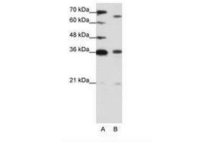 Image no. 1 for anti-PR Domain Containing 13 (PRDM13) (C-Term) antibody (ABIN202883) (PRDM13 antibody  (C-Term))