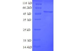 SDS-PAGE (SDS) image for Thymidine Kinase 1, Soluble (TK1) (AA 1-376), (full length) protein (His tag) (ABIN5710502)