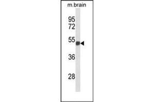 Western blot analysis of FOXG1 Antibody (Center) in mouse brain tissue lysates (35ug/lane). (FOXG1 antibody  (Middle Region))