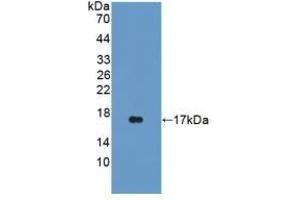 Detection of Recombinant iNV, Rat using Polyclonal Antibody to Involucrin (INV) (Involucrin antibody  (AA 461-551))