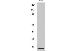 Western Blot analysis of various cells using p15 Polyclonal Antibody diluted at 1:500.