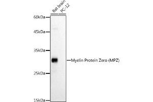 Western blot analysis of extracts of various cell lines, using Myelin Protein Zero (MPZ) antibody (ABIN3022393, ABIN3022394, ABIN1513218 and ABIN6218782) at 1:1000 dilution. (MPZ antibody)
