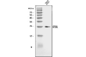 Western blot analysis of CITED1 using anti-CITED1 antibody (ABIN7598978).