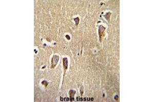 CRFR2 Antibody (D35) immunohistochemistry analysis in formalin fixed and paraffin embedded human brain tissue followed by peroxidase conjugation of the secondary antibody and DAB staining. (CRHR2 antibody  (AA 27-58))