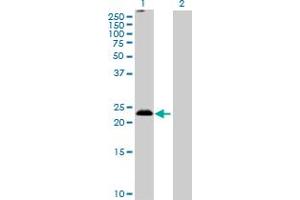 Western Blot analysis of MS4A5 expression in transfected 293T cell line by MS4A5 MaxPab polyclonal antibody. (MS4A5 antibody  (AA 1-200))