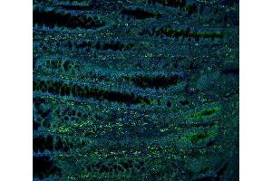 IF analysis of ME2 using anti-ME2 antibody (ABIN7600967). (NAD-ME antibody  (AA 26-584))