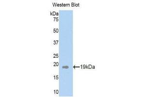Western Blotting (WB) image for anti-Plexin B1 (PLXNB1) (AA 200-727) antibody (ABIN1860270) (PLXNB1 antibody  (AA 200-727))