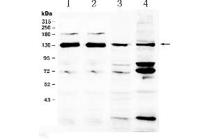 Western blot analysis of NCKAP1 using anti- NCKAP1 antibody .