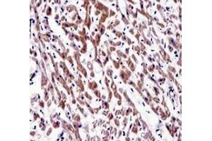 Immunohistochemistry analysis in human heart tissue (Formalin-fixed, Paraffin-embedded) using MOV10 Antibody (N-term), followed by peroxidase conjugated secondary antibody and DAB staining.