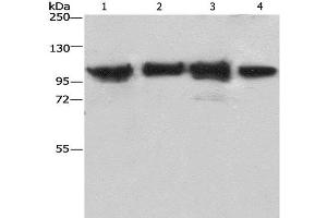 Western Blot analysis of Lovo cell and Mouse kidney tissue, 231 and hepG2 cell using ACTN4 Polyclonal Antibody at dilution of 1:485 (alpha Actinin 4 antibody)