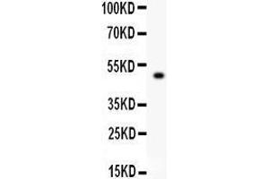 Western Blotting (WB) image for anti-Tight Junction Protein 1 (TJP1) (AA 1178-1527) antibody (ABIN3043312)