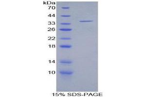 SDS-PAGE (SDS) image for Integrin alpha-L (ITGAL) (AA 809-1066) protein (His tag) (ABIN2125744)
