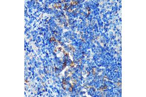 Immunohistochemistry of paraffin-embedded Rat spleen using GMIP Rabbit pAb (ABIN7267369) at dilution of 1:100 (40x lens). (GMIP antibody  (AA 1-91))