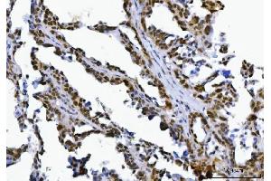 IHC analysis of SPT5/SUPT5H using anti-SPT5/SUPT5H antibody (ABIN7601985). (SUPT5H antibody  (AA 533-1087))