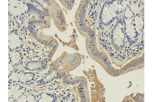 Immunohistochemical staining of rat colon using anti-syntaxin antibody ABIN7072248 Formalin fixed rat colon slices were were stained with ABIN7072248 at 3 μg/mL. (Recombinant Syntaxin antibody)