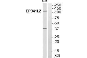 Western Blotting (WB) image for anti-erythrocyte Membrane Protein Band 4.1-Like 2 (EPB41L2) (Internal Region) antibody (ABIN1850881) (EPB41L2 antibody  (Internal Region))