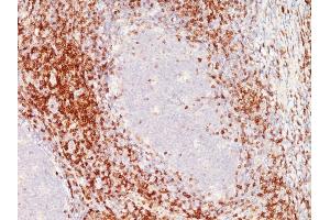 Formalin-fixed, paraffin-embedded Tonsil stained with CD6 Monoclonal Antibody (SPM547)