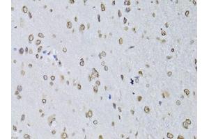Immunohistochemistry of paraffin-embedded rat brain using LMNB2 Antibody (ABIN2563696) at dilution of 1:100 (40x lens). (Lamin B2 antibody)